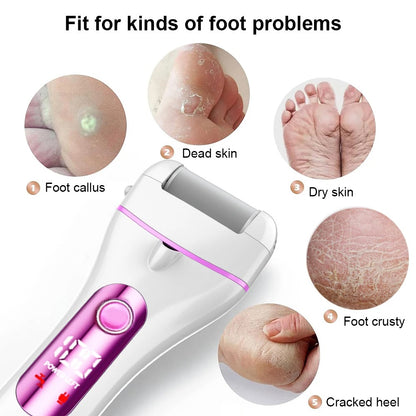 Electric Sole Mate - Foot File Foot Remover