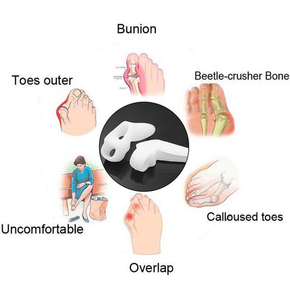 Toe Straightener - 1 Pair